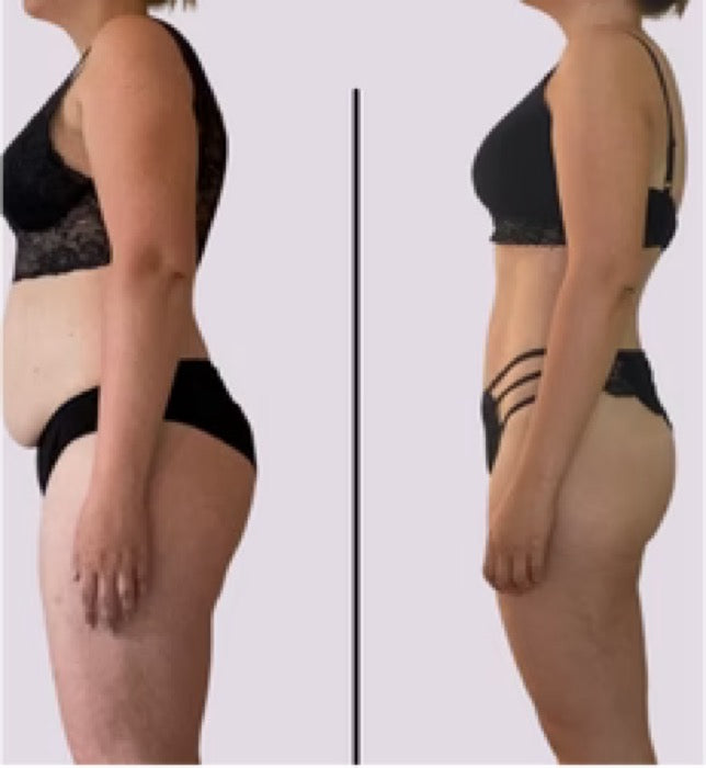 Før og efter — Missfit-medlem