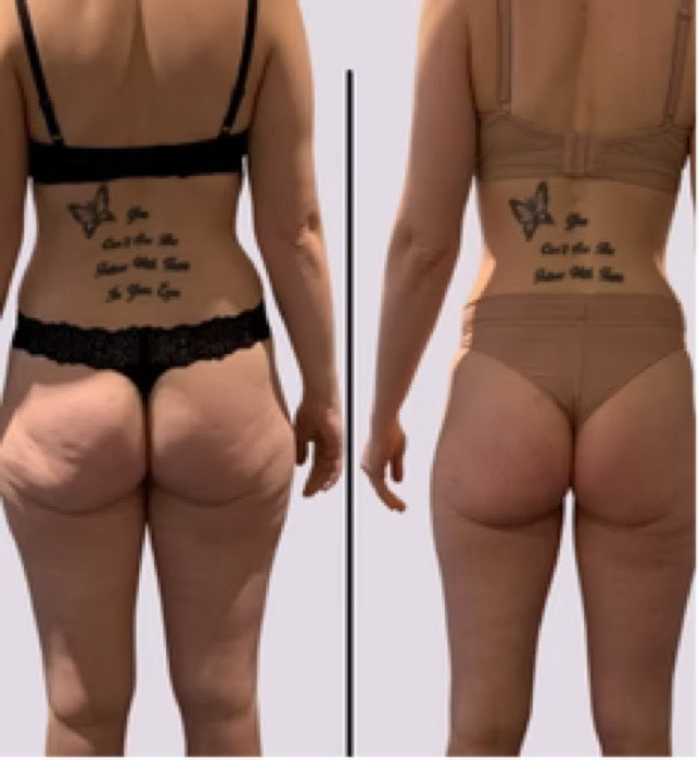 Før og efter — Missfit-medlem