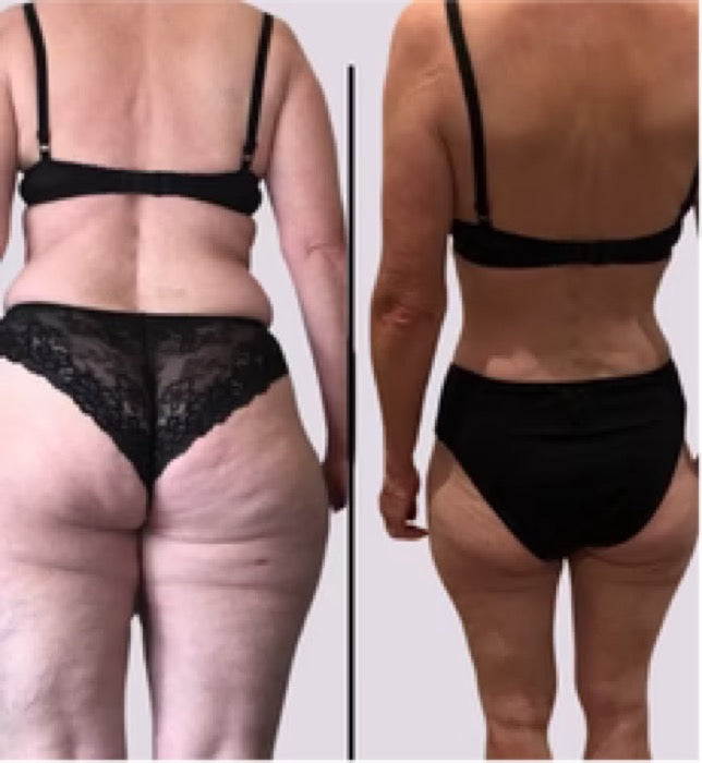 Før og efter — Missfit-medlem