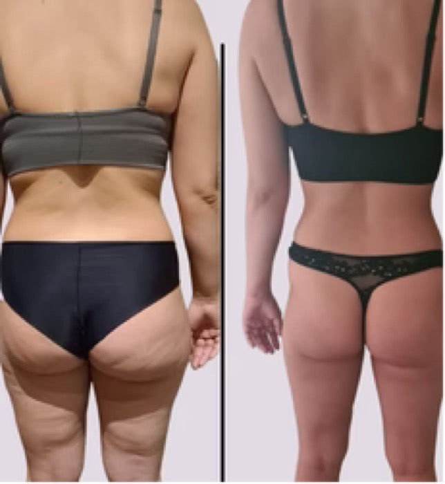 Før og efter — Missfit-medlem