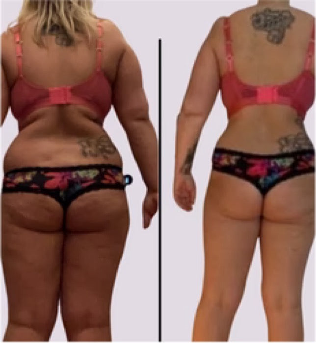 Før og efter — Missfit-medlem