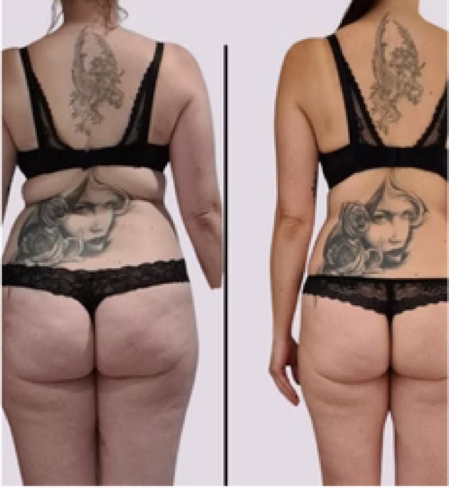 Før og efter — Missfit-medlem