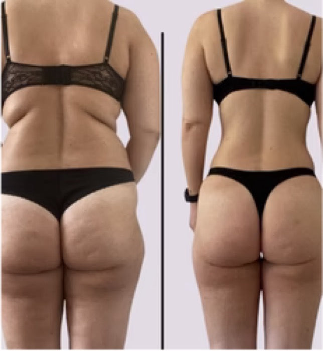 Før og efter — Missfit-medlem