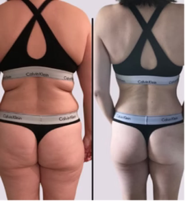 Før og efter — Missfit-medlem